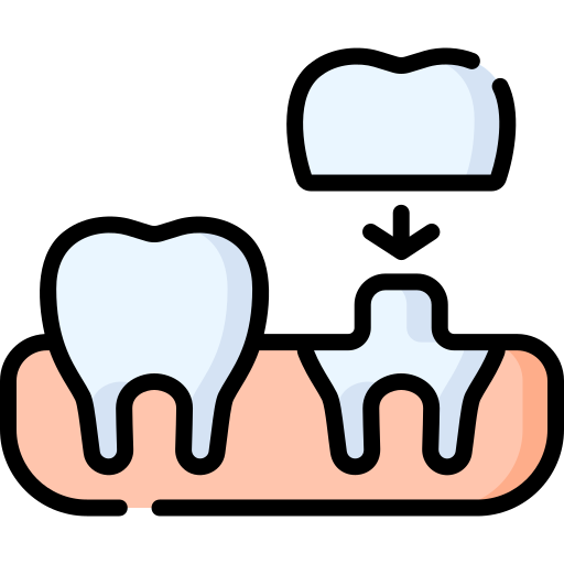 dental crown Illustration